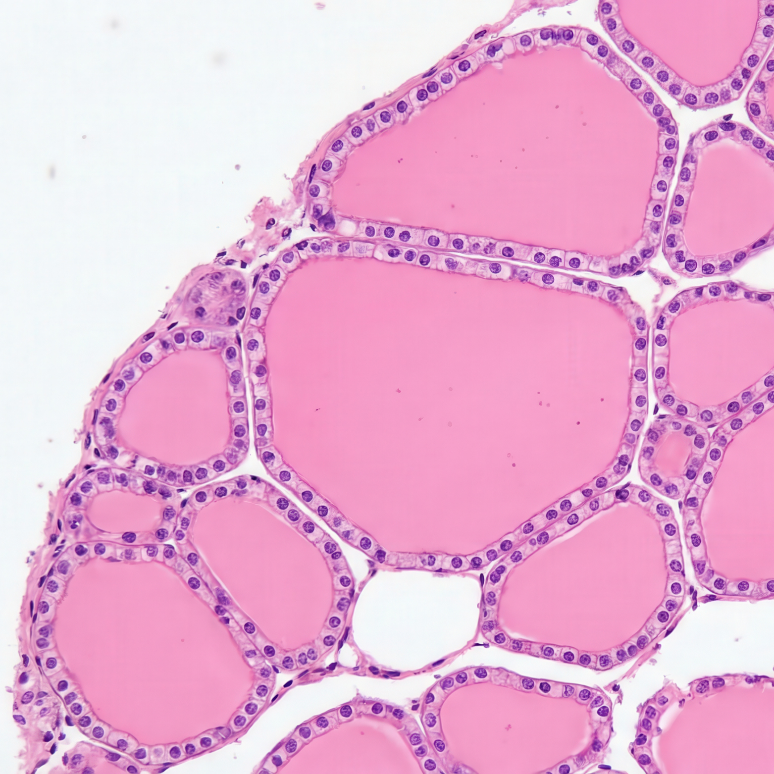 firkantede billeder (1)(2)